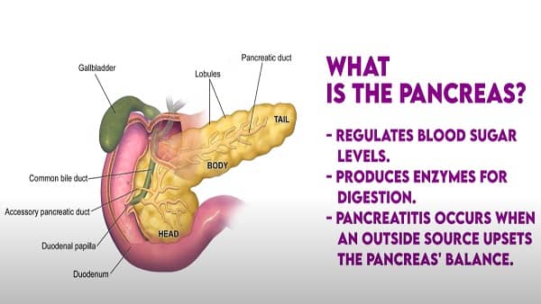 what is pancreatitis